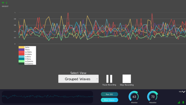 Excellent Brain - Brain Waves Sampler - EEG Recorder