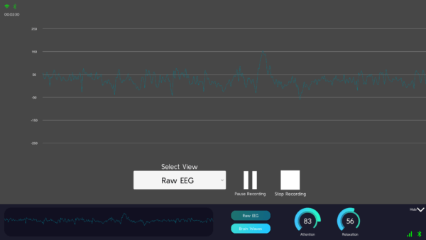 Excellent Brain - Brain Waves Sampler - EEG Recorder
